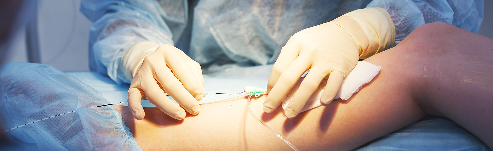 Laser endoveineux traitement des varices casablanca Maroc